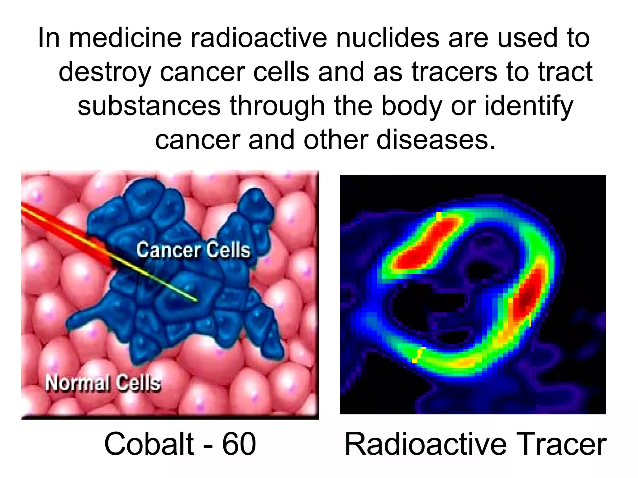 In medicine radioactive nuclides are used to destroy cancer cells and as tracers to tract substances through the body or identify cancer and other diseases. Cobalt - 60 Radioactive Tracer 