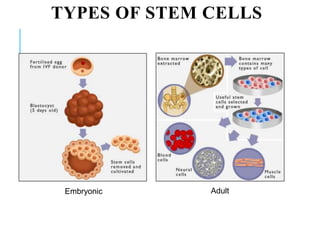TYPES OF STEM CELLS
Embryonic Adult
 