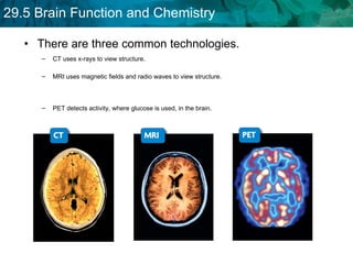 There are three common technologies. CT uses x-rays to view structure. PET detects activity, where glucose is used, in the brain. MRI uses magnetic fields and radio waves to view structure. 
