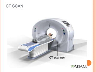 CT SCAN
 