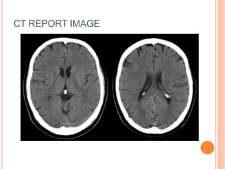 CT REPORT IMAGE
 