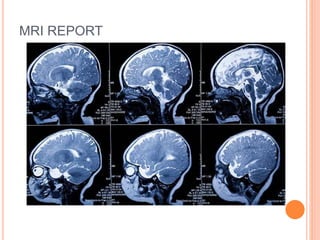 MRI REPORT
 