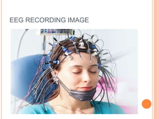 EEG RECORDING IMAGE
 