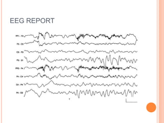 EEG REPORT
 