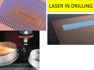 LASER IN DRILLING
.
 