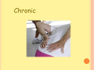 Chronic