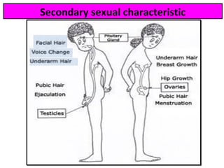 Secondary sexual characteristic
 