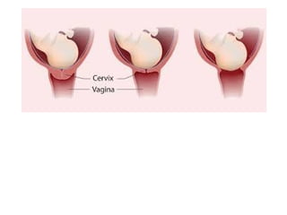Unit 3. REPRODUCTION