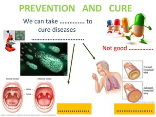 PREVENTION AND CURE
We can take …………... to
cure diseases
…………………………..
………………..…………….
Not good …………….
 