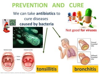 PREVENTION AND CURE
We can take antibiotics to
cure diseases
caused by bacteria
bronchitistonsillitis
Not good for viruses
 