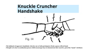 Knuckle Cruncher
Handshake
Fig. 14
-The hallmark of aggressive handshake whereby one or both participators firmly squeeze offered hand.
-Thought to be due to socialization process which encourages boys to demonstrate their assertive, powerful, “manly” attributes.
 