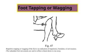 Foot Tapping or Wagging
Fig. 47
-Repetitive tapping or wagging of the foot is an indication of impatience, boredom, or nervousness.
-The redundant foot movements are said to reflect a latent desire to run away.
 