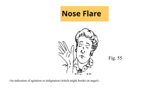 Nose Flare
Fig. 55
-An indication of agitation or indignation (which might border on anger).
 