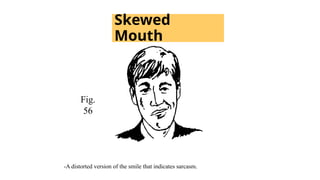 Skewed
Mouth
Fig.
56
-A distorted version of the smile that indicates sarcasm.
 