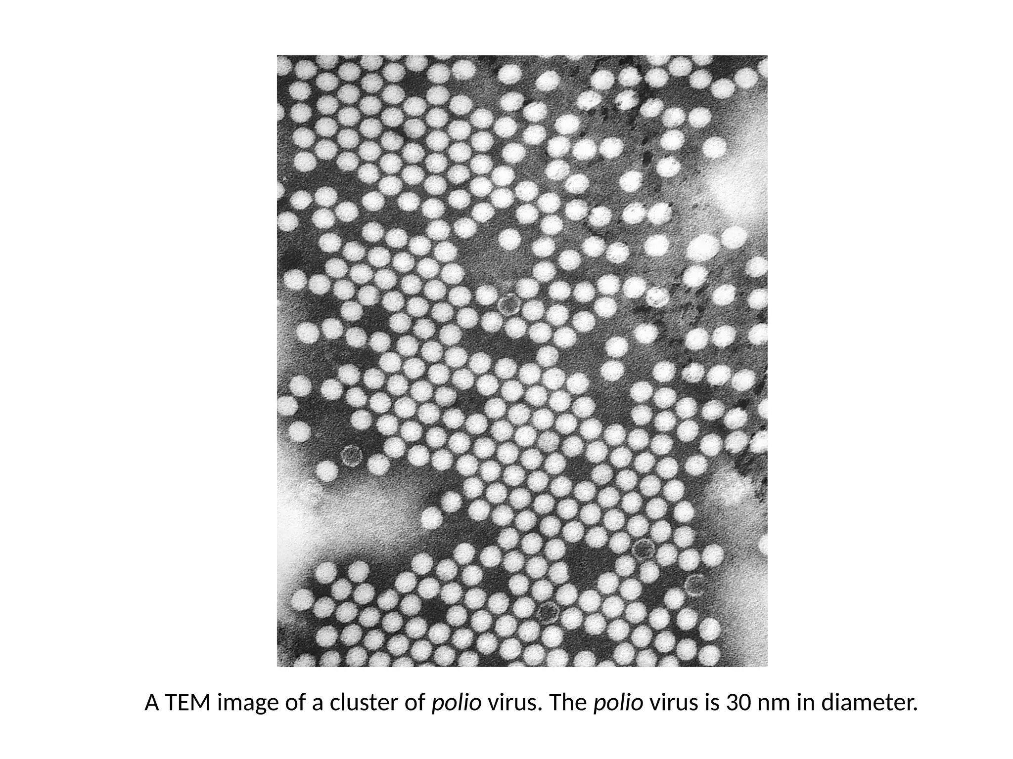 A TEM image of a cluster of polio virus. The polio virus is 30 nm in diameter.
 
