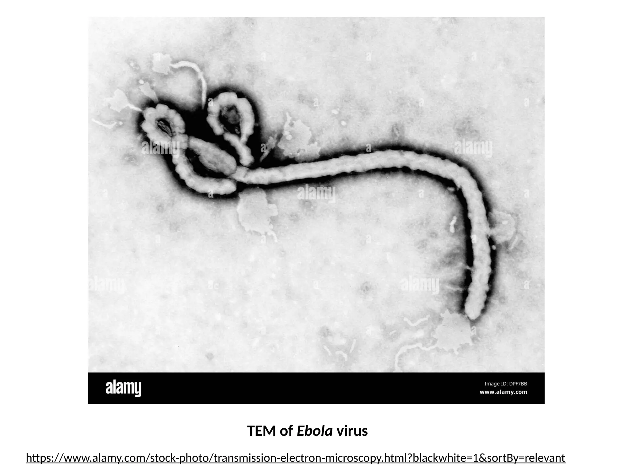TEM of Ebola virus
https://www.alamy.com/stock-photo/transmission-electron-microscopy.html?blackwhite=1&sortBy=relevant
 