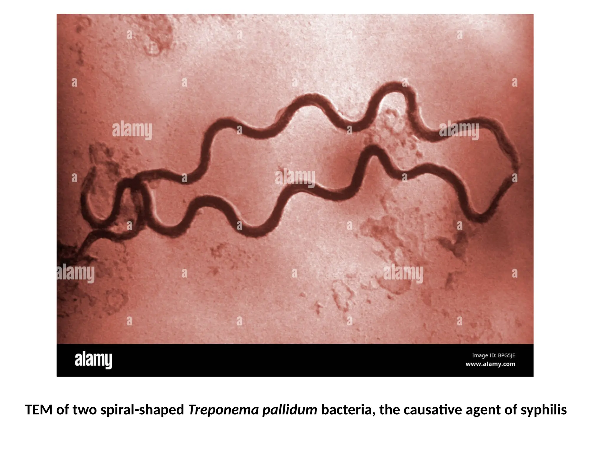 TEM of two spiral-shaped Treponema pallidum bacteria, the causative agent of syphilis
 