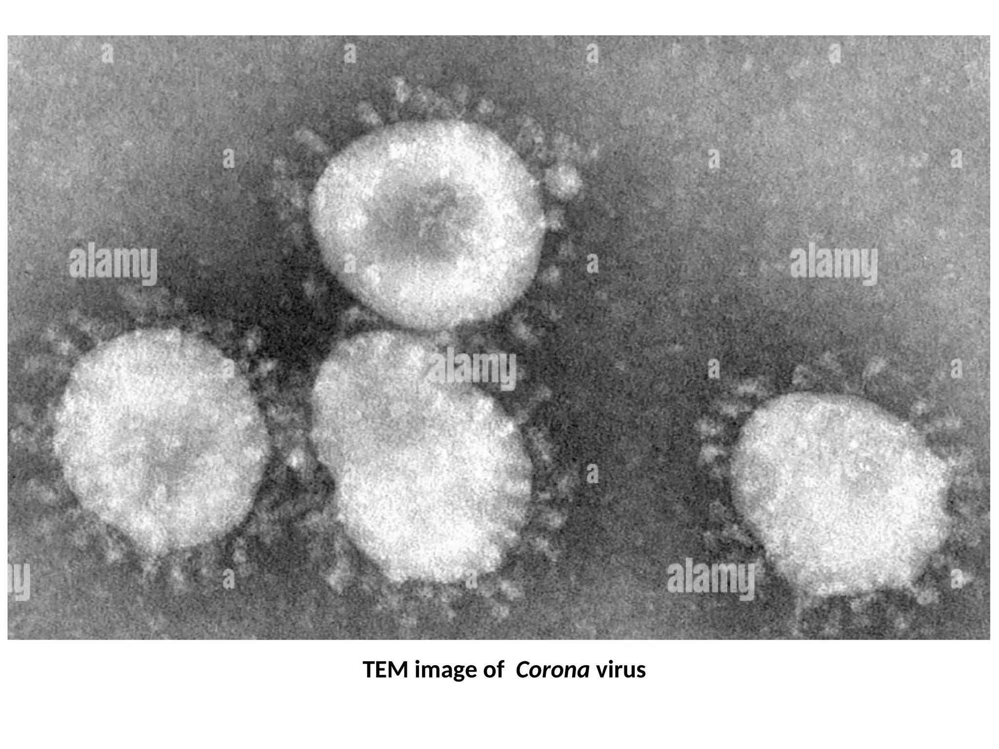 TEM image of Corona virus
 