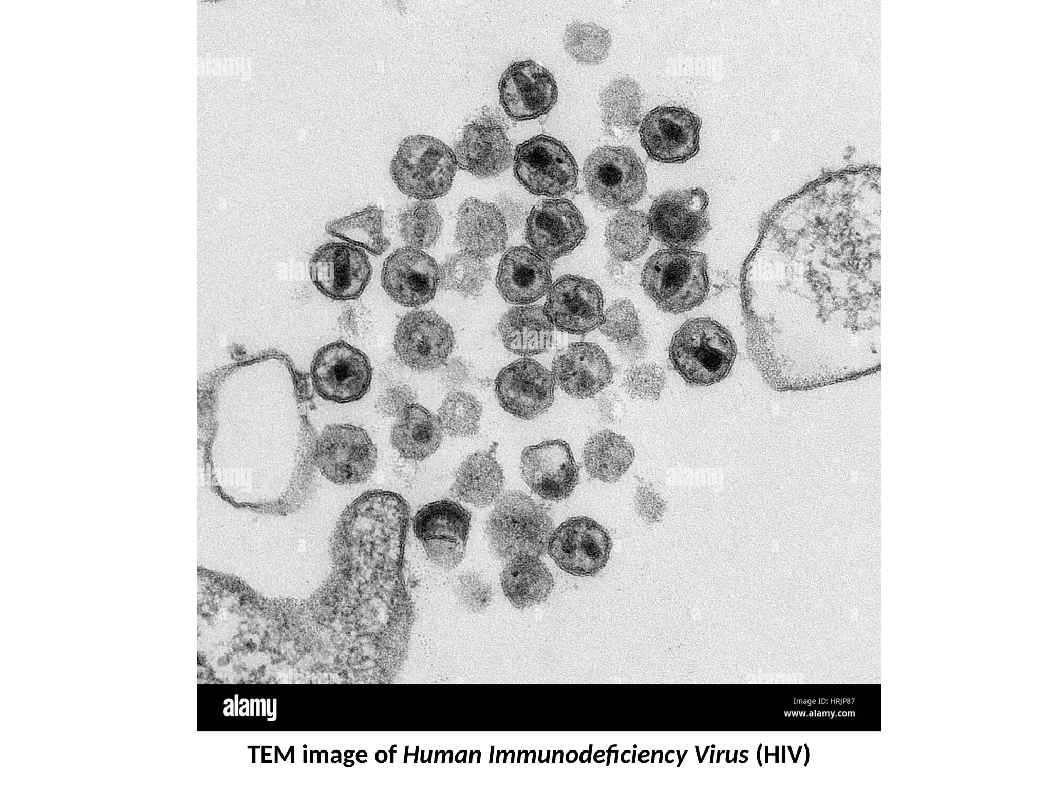 TEM image of Human Immunodeficiency Virus (HIV)
 