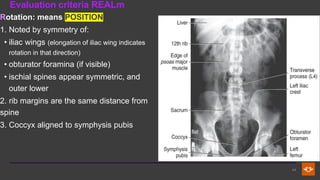 Internal Ilium Rotation Comprehensive Radiographic Techniques and Anatomy of the Abdomen | PDF