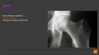 Comprehensive Radiographic Techniques and Anatomy of the Abdomen | PDF