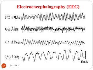 Electroencephalography (EEG)
.
17 DEEPAK.P
 