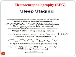 Electroencephalography (EEG)
.
21 DEEPAK.P
 