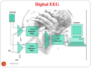 Digital EEG
30 DEEPAK.P
 