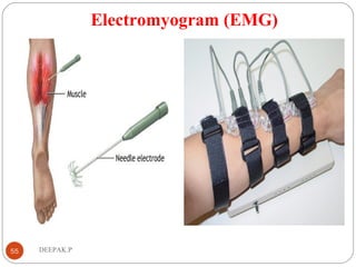Electromyogram (EMG)
55 DEEPAK.P
 