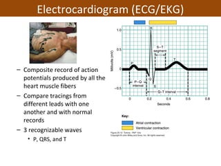 – Composite record of action
potentials produced by all the
heart muscle fibers
– Compare tracings from
different leads with one
another and with normal
records
– 3 recognizable waves
• P, QRS, and T
Electrocardiogram (ECG/EKG)
 