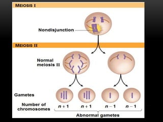 Nondisjunction
MEIOSIS I
MEIOSIS II
Normal
meiosis II
Gametes
Number of
chromosomes
Abnormal gametes
n  1 n  1 n  1 n  1
 