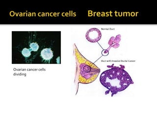 Ovarian cancer cells
dividing
 