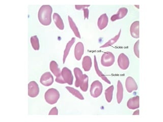 Unit 3 rbc disorders | ODP