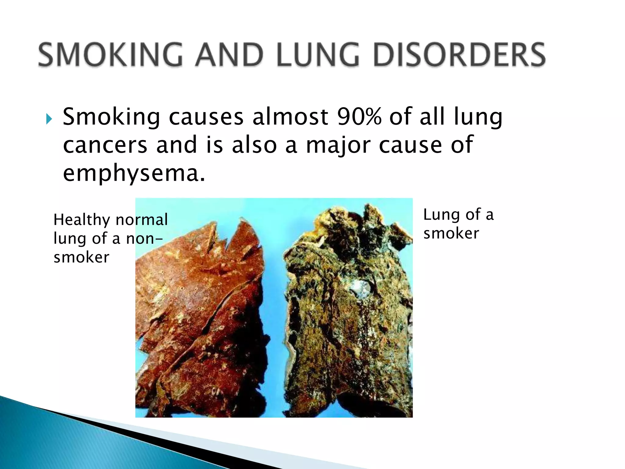    Smoking causes almost 90% of all lung
    cancers and is also a major cause of
    emphysema.
Healthy normal                    Lung of a
lung of a non-                    smoker
smoker
 