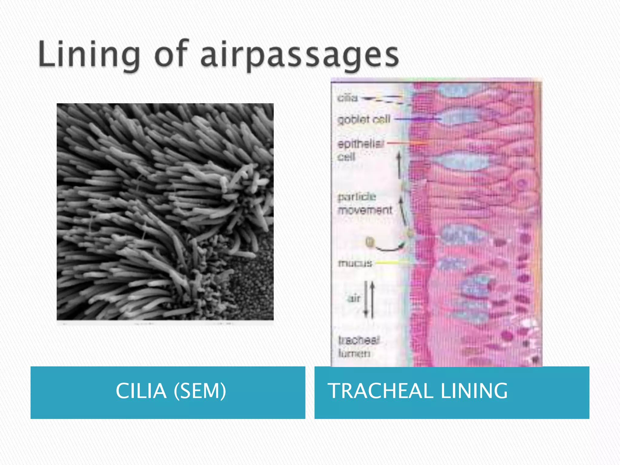 CILIA (SEM)   TRACHEAL LINING
 