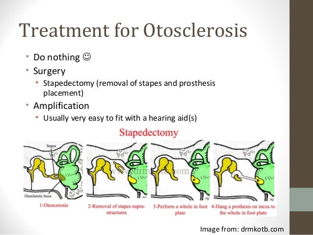 Medical Imaging Otitis Media And Otosclerosis