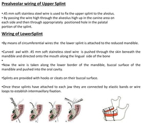 Unit 3 Splints.pptx
