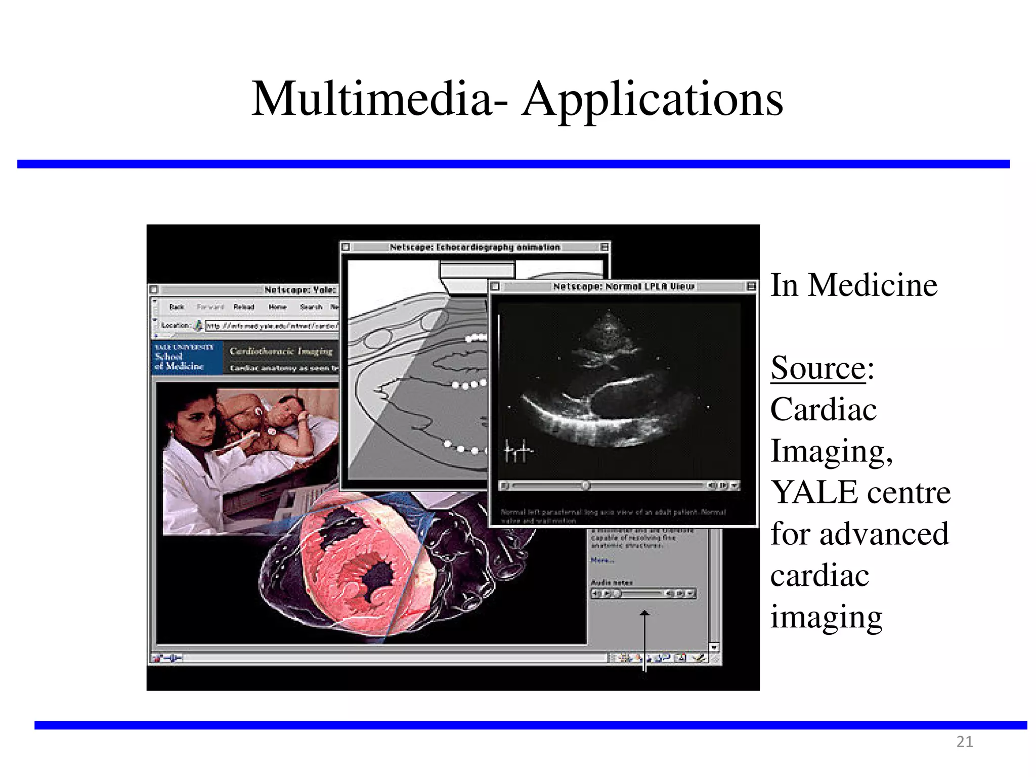 Multimedia- Applications

In Medicine
Source:
Cardiac
Imaging,
YALE centre
for advanced
cardiac
imaging

21

 