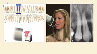 Comprehensive Guide to Dental Radiographic Techniques and Procedures | PPTX