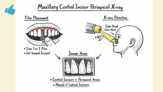 Comprehensive Guide to Dental Radiographic Techniques and Procedures | PPTX