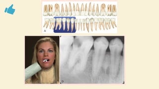 Comprehensive Guide to Dental Radiographic Techniques and Procedures | PPTX