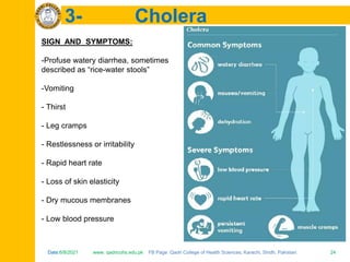 Date:6/8/2021 www. qadricohs.edu.pk FB Page: Qadri College of Health Sciences, Karachi, Sindh, Pakistan. 24
Date:6/8/2021 www. qadricohs.edu.pk FB Page: Qadri College of Health Sciences, Karachi, Sindh, Pakistan. 24
3- Cholera
SIGN AND SYMPTOMS:
-Profuse watery diarrhea, sometimes
described as “rice-water stools”
-Vomiting
- Thirst
- Leg cramps
- Restlessness or irritability
- Rapid heart rate
- Loss of skin elasticity
- Dry mucous membranes
- Low blood pressure
 