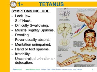 Date:6/8/2021 www. qadricohs.edu.pk FB Page: Qadri College of Health Sciences, Karachi, Sindh, Pakistan. 9
Date:6/8/2021 www. qadricohs.edu.pk FB Page: Qadri College of Health Sciences, Karachi, Sindh, Pakistan. 9
1- TETANUS
SYMPTOMS INCLUDE:
- Lock Jaw.
- Stiff Neck.
- Difficulty Swallowing.
- Muscle Rigidity Spasms.
- Drooling.
- Fever usually absent.
- Mentation unimpaired.
- Hand or foot spasms.
- Irritability.
- Uncontrolled urination or
defecation.
 