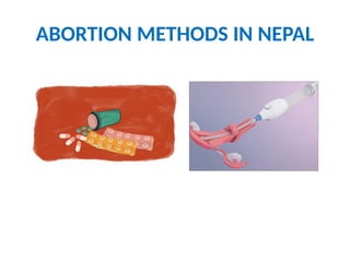 ABORTION METHODS IN NEPAL
 