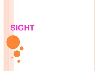 SIGHT
 