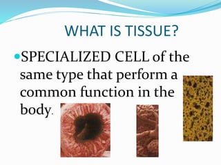 WHAT IS TISSUE?
SPECIALIZED CELL of the
same type that perform a
common function in the
body.
 