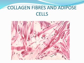 COLLAGEN FIBRES AND ADIPOSE
CELLS
 