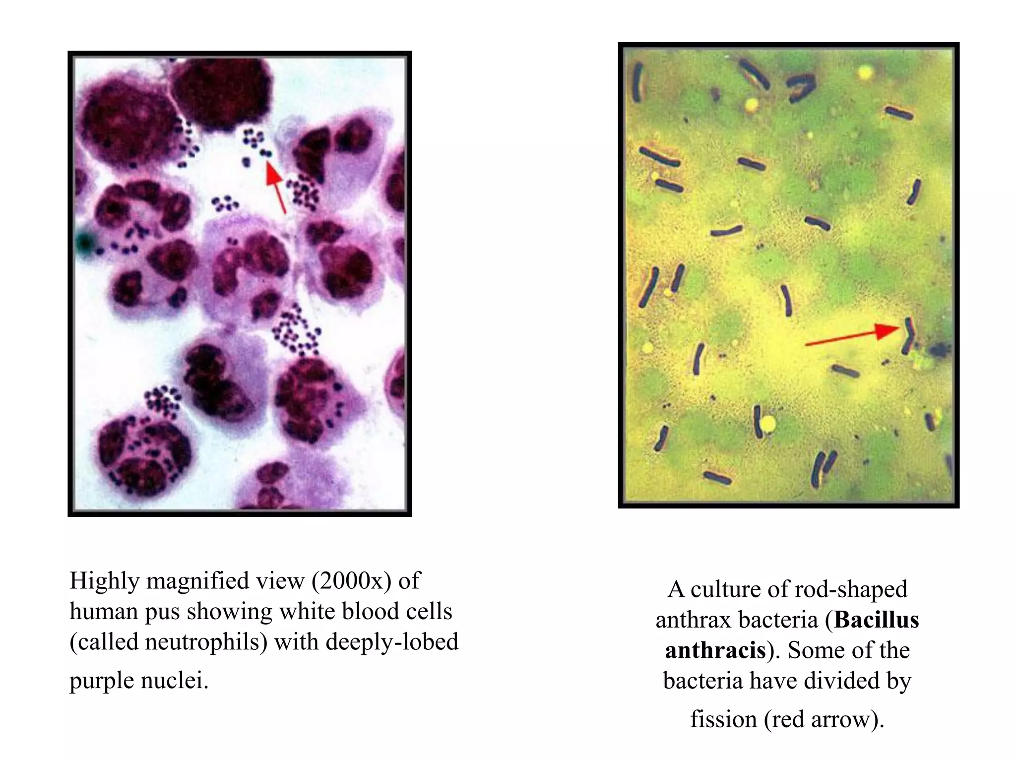 Highly magnified view (2000x) of          A culture of rod-shaped
human pus showing white blood cells      anthrax bacteria (Bacillus
(called neutrophils) with deeply-lobed    anthracis). Some of the
purple nuclei.                            bacteria have divided by
                                            fission (red arrow).
 