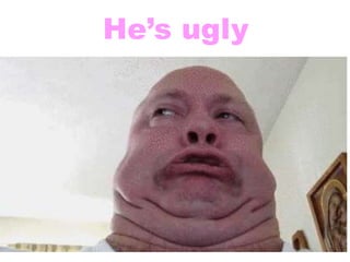 He’s ugly
 