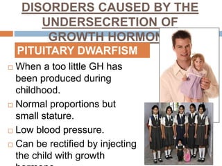 DISORDERS CAUSED BY THE
UNDERSECRETION OF
GROWTH HORMONE
 When a too little GH has
been produced during
childhood.
 Normal proportions but
small stature.
 Low blood pressure.
 Can be rectified by injecting
the child with growth
PITUITARY DWARFISM
 